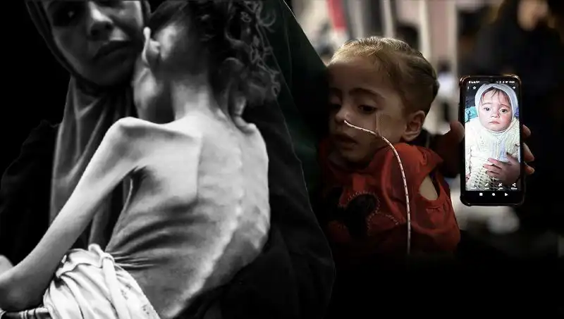 Küçük Meryem'in Mücadelesi: 25 Kilodan 10 Kiloya Düşen Zorlu Yaşamı